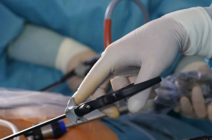 Laparoscopic Gynecological Surgeries-----11